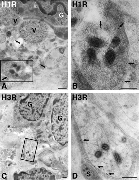 Abbildung 4 4 Immunogoldfärbung gegen H1R und H3R im Glomus caroticum