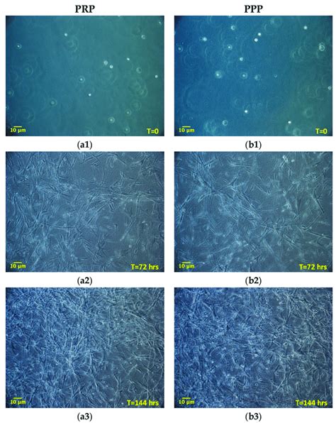 Morphology Of Admscs Grown Inside A 3d Matrix Prepared From Download Scientific Diagram