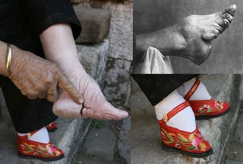 Wonderful World Chinese Foot Binding