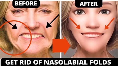 10 Min Face Lifting Exercises For Nasolabial Folds Laugh Lines