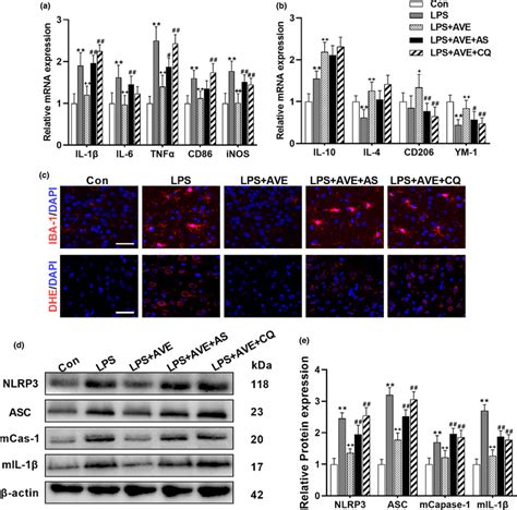 Inhibition Of Foxo1 Or Autophagy Compromised The Antioxidative And