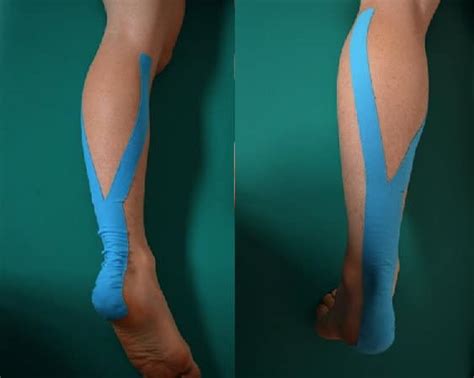 Como Aplicar O Kinesio Tape Para O Joelho Ombro E Tornozelo