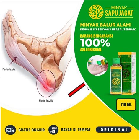 Jual Obat Sakit Pada Tumit Kaki Nyeri Tumit Tumit Sakit Plantar