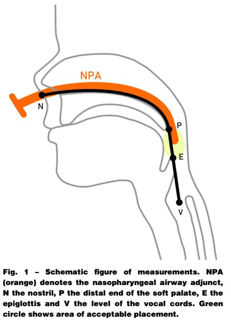 Nasopharyngeal Airway Anatomy