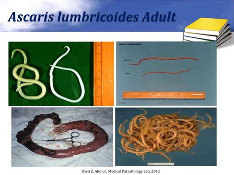 Ascaris Lumbricoides Causes