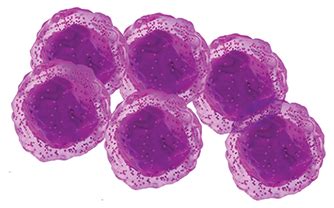 IDH1 in AML & TIBSOVO® (ivosidenib tablets) Mechanism of Action