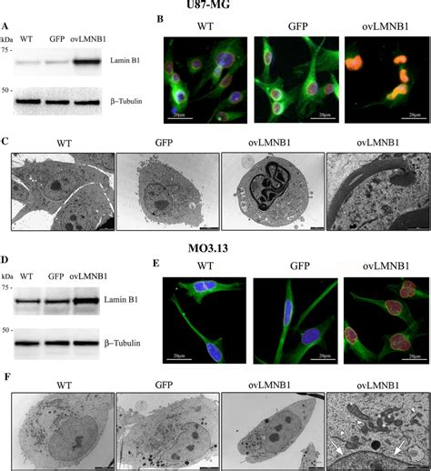 Lamin B Overexpression Affects Nuclear Morphology In U Mg Cells