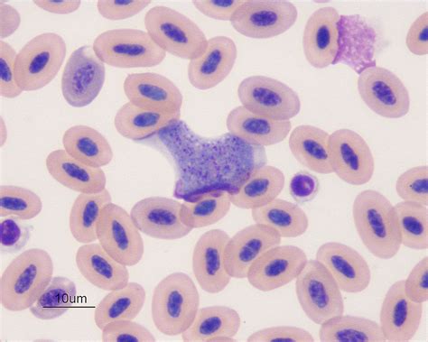 Avian Blood Parasites EClinpath