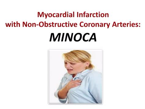 Fourth Universal Definition Of Myocardial Infarction Ppt