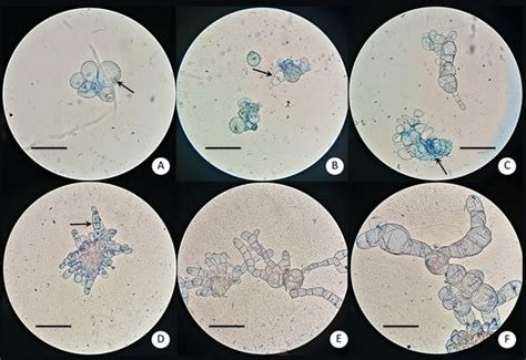 Microscopic Visualization 10x Of Cells In The Suspension Culture In