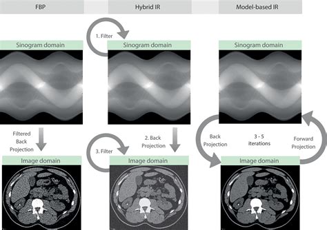 Deep Learning Image Reconstruction For Ct Technical Principles And