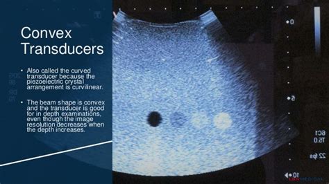 Ultrasound Transducer Types