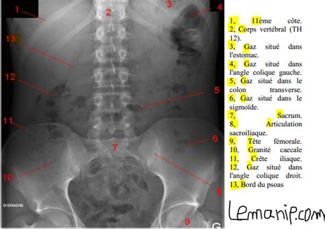 Asp Abdomen Sans Pr Paration