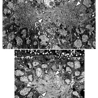 Midline Fusion Of Commissural And Longitudinal Axons In Embryos Mutant