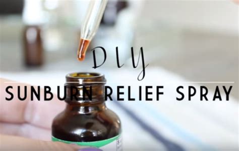 Diy Sunburn Relief Spray