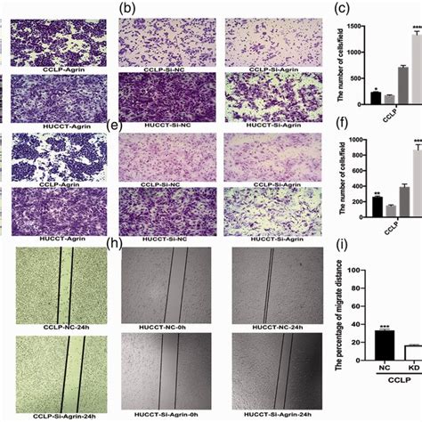 Ectopic Agrin Expression Promoted Migration And Invasion A But Agrin