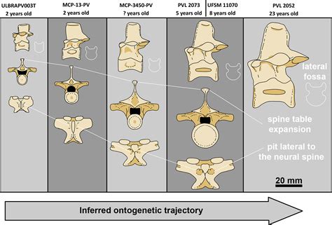 Scielo Brasil Intraspecific Variation In The Axial Skeleton Of