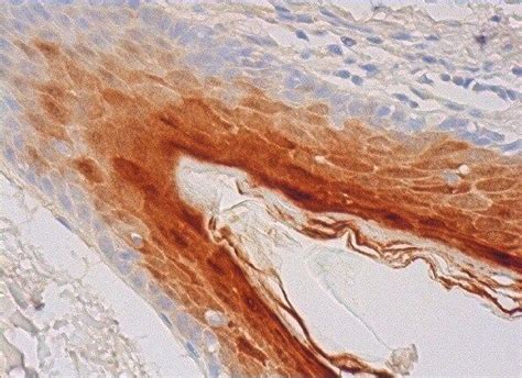 Psoriasin Anticuerpo H Scbt Santa Cruz Biotechnology