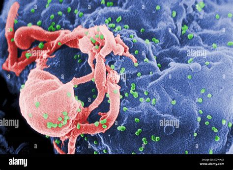 Electron Micrograph Of Human Immunodeficiency Virus Hiv Stock Photo