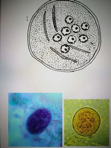 Entamoeba Coli Flashcards Quizlet