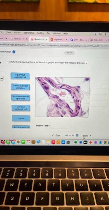 Solved Ifentfy The Following Tissue In The Micrograph And Chegg