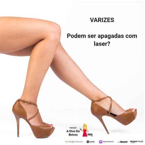 Você sabia que é possível apagar varizes O laser NDYAG pulso longo é