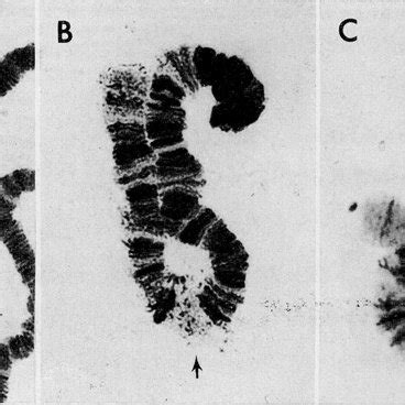 Chromosomes A From Salivary Gland G Intestine I And Malpighian