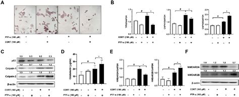 Figure From P Knock Out Mice Enhances Anxiety And Depression Like