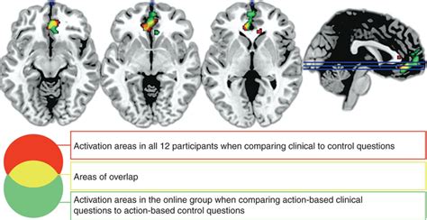 Depicted Brain Activation Areas Download Scientific Diagram