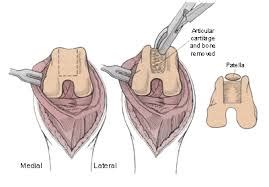 Medial Luxating Patella — Warm Springs Pet Hospital