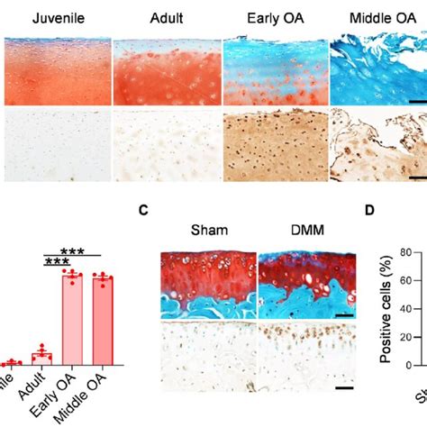 Spla Expression In Human And Mouse Oa Cartilage A Representative