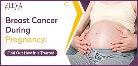 Breast Cancer Treatment During Pregnancy Zeeva Oncology