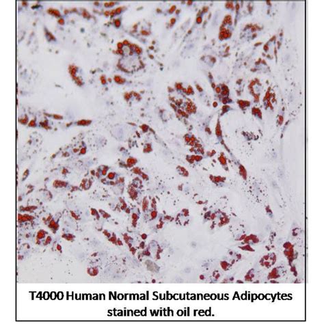 Get T4000 Human Primary Subcutaneous Adipocytes From MBP INC