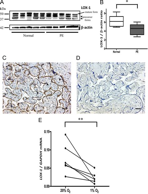 Expression Of LOX 1 Protein In Placenta And MRNA Expression Under