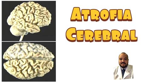 Atrofia Cerebral Difusa