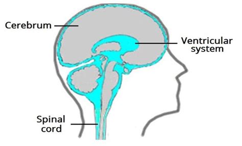 Intracranial Pressure Icp Monitoring Flashcards Quizlet