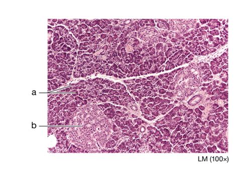 Pancreas gland Quiz