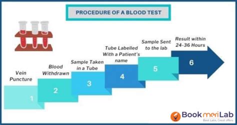 Anti Tpo Test Price Purpose Results And Range Bookmerilab