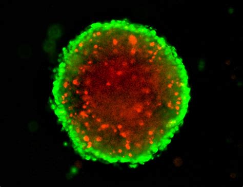 3d Spheroid Assays For Cancer Drug Screening Scientist Live