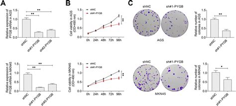 Pygb Knockdown Suppressed Proliferation Of Gastric Cancer Cell