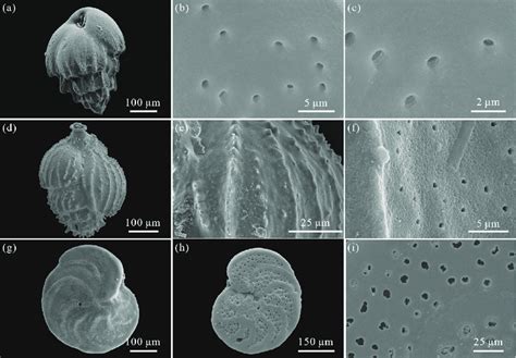 Scanning Electron Microscope Images Of The Benthic Foraminifera In This