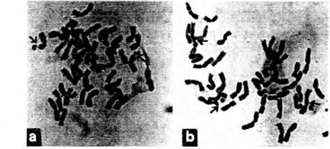 Chromosome Configuration Showing Satellite Chromosomes Arrow Marked Download Scientific