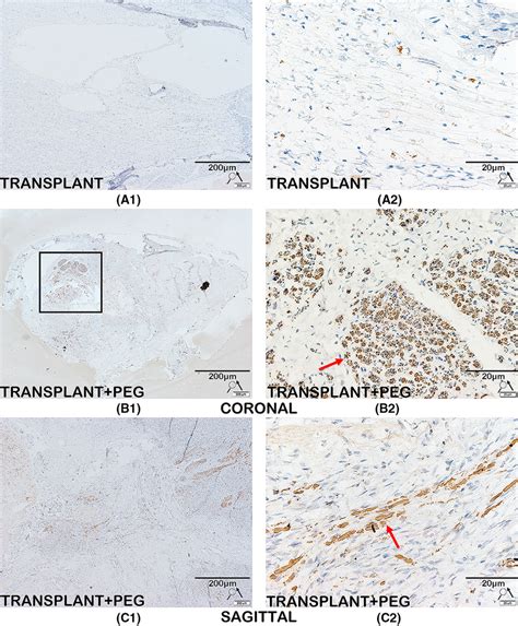 Immunohistochemistry For Neurofilament Protein Immunolabeling Of