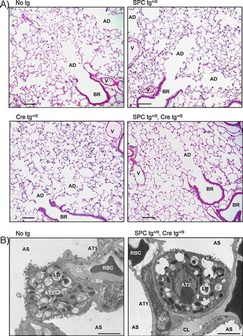 Enacmediated Alveolar Fluid Clearance And Lung Fluid Balance Depend On