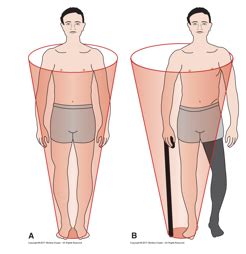 Exam 2 Abnormal Postural Control Impaired Steady State Balance