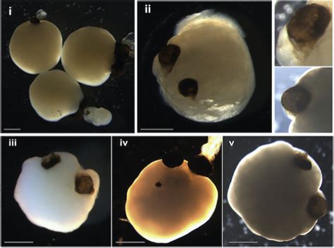 Mini Brains Grown In The Lab Sprout Primitive Eyes