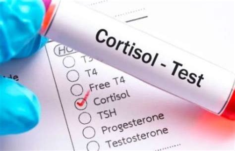 Articole Despre Hormonul Stresului AflaCum Ro