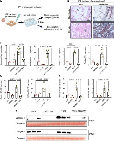 Jci Insight Transcriptional Analysis Of Lung Fibroblasts Identifies