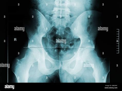 Radiolog A De Pelvis Fotograf As E Im Genes De Alta Resoluci N Alamy