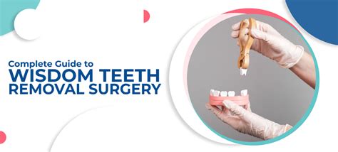 Guide To Wisdom Teeth Removal Surgery